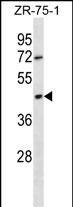 OR2T6 Antibody (C-term) western blot analysis in ZR-75-1 cell line lysates (35ug/lane).This demonstrates the OR2T6 antibody detected the OR2T6 protein (arrow).