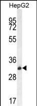 Western Blot OR4K5 Antibody (RB29965)