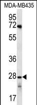 OR10AG1 Antibody (C-term) western blot analysis in MDA-MB435 cell line lysates (35ug/lane).This demonstrates the OR10AG1 antibody detected the OR10AG1 protein (arrow).