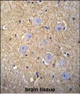 Confocal immunofluorescent analysis of OR2T3 Antibody (C-term) with 293 cell followed by Alexa Fluor 488-conjugated goat anti-rabbit lgG (green). Dused to stain the cell nuclear (blue).
