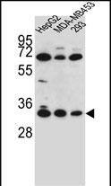 Confocal immunofluorescent analysis of OR2T3 Antibody (C-term) with 293 cell followed by Alexa Fluor 488-conjugated goat anti-rabbit lgG (green). Dused to stain the cell nuclear (blue).