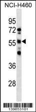 RBMY1D Antibody (C-term) western blot analysis in NCI-H460 cell line lysates (35ug/lane).This demonstrates the RBMY1D antibody detected the RBMY1D protein (arrow).