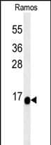Western Blot C1orf186 Antibody (RB27426)