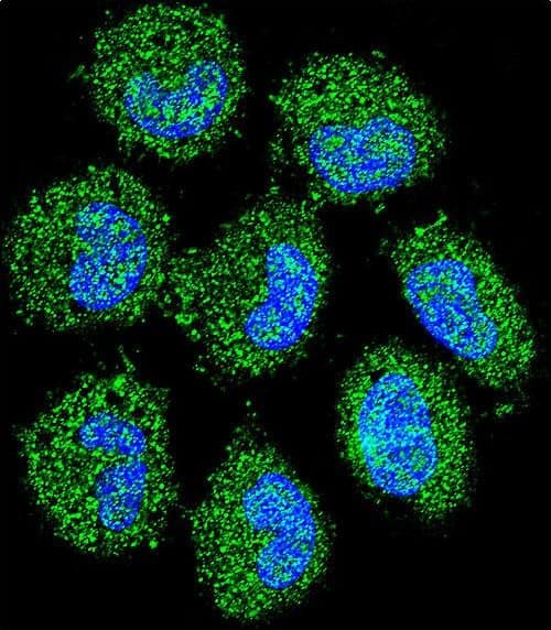 Confocal immunofluorescent analysis of PRAMEF6 Antibody (C-term) with NCI-H460 cell followed by Alexa Fluor 488-conjugated goat anti-rabbit lgG (green). Dused to stain the cell nuclear (blue).
