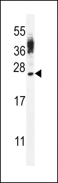 CT45A Antibody (Center) western blot analysis in WiDr cell line lysates (35ug/lane).This demonstrates the CT45A antibody detected the CT45A protein (arrow).