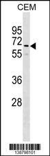 GOLGA8B Antibody (N-term) western blot analysis in CEM cell line lysates (35ug/lane).This demonstrates the GOLGA8B antibody detected the GOLGA8B protein (arrow).