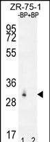 Western blot analysis of RAB40AL Antibdy (N-term) Pab pre-incubated without(lane 1) and with(lane 2) blocking peptide in ZR-75-1 cell line lysate. RAB40AL Antibdy (N-term) (arrow) was detected using the purified Pab.
