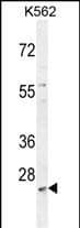 MCART2 Antibody (N-term) western blot analysis in K562 cell line lysates (35ug/lane).This demonstrates the MCART2 antibody detected the MCART2 protein (arrow).