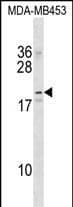 Western Blot NKAIN2 Antibody (RB36434)