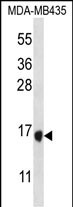 TAC4 Antibody (C-term) western blot analysis in MDA-MB435 cell line lysates (35ug/lane).This demonstrates the TAC4 antibody detected the TAC4 protein (arrow).