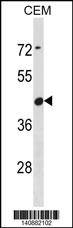 CBWD6 Antibody (Center) western blot analysis in CEM cell line lysates (35ug/lane).This demonstrates the CBWD6 antibody detected the CBWD6 protein (arrow).