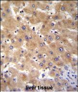 GAGE12B Antibody (N-term) western blot analysis in T47D cell line lysates (35ug/lane).This demonstrates the GAGE12B antibody detected the GAGE12B protein (arrow).