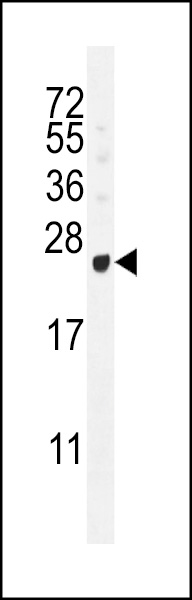 GAGE12B Antibody (N-term) western blot analysis in T47D cell line lysates (35ug/lane).This demonstrates the GAGE12B antibody detected the GAGE12B protein (arrow).