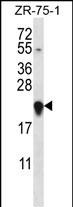 GAGE12H Antibody (N-term) western blot analysis in ZR-75-1 cell line lysates (35ug/lane).This demonstrates the GAGE12H antibody detected the GAGE12H protein (arrow).