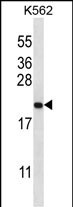 GAGE2B Antibody (N-term) western blot analysis in K562 cell line lysates (35ug/lane).This demonstrates the GAGE2B antibody detected the GAGE2B protein (arrow).