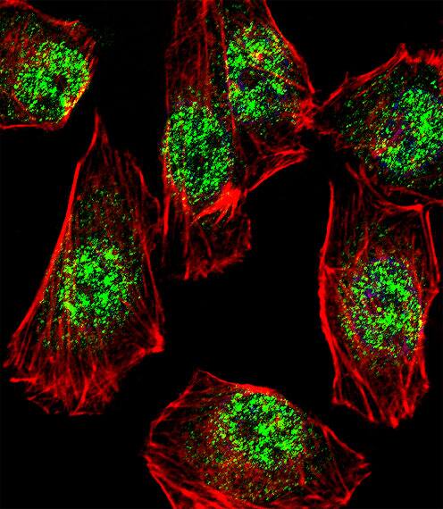 Fluorescent confocal image of A549 cell stained with RHOXF2B Antibody (Center).A549 cells were fixed with 4% PFA (20 min), permeabilized with Triton X-100 (0.1%, 10 min), then incubated with RHOXF2B primary antibody (1:25, 1 h at 37?). For secondary antibody, Alexa Fluor� 488 conjugated donkey anti-rabbit antibody (green) was used (1:400, 50 min at 37?).Cytoplasmic actin was counterstained with Alexa Fluor� 555 (red) conjugated Phalloidin (7units/ml, 1 h at 37?). Nuclei were counterstained with De) (10 �g/ml, 10 min).RHOXF2B immunoreactivity is localized to Nucleus significantly.
