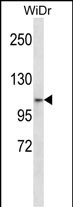 ZNF836 Antibody (N-term) western blot analysis in WiDr cell line lysates (35ug/lane).This demonstrates the ZNF836 antibody detected the ZNF836 protein (arrow).
