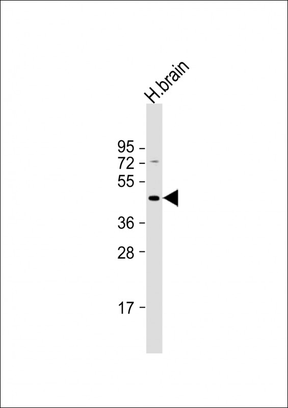 Anti-GBRR3 Antibody (N-term) at 1:1000 dilution + human brain lysateLysates/proteins at 20 �g per lane. SecondaryGoat Anti-Rabbit IgG, (H+L), Peroxidase conjugated at 1/10000 dilution. Predicted band size : 54 kDaBlocking/Dilution buffer: 5% NFDM/TBST.