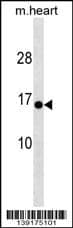 HIGD1C Antibody (C-term) western blot analysis in mouse heart tissue lysates (35ug/lane).This demonstrates the HIGD1C antibody detected the HIGD1C protein (arrow).