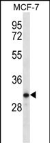TESSP1 Antibody (Center) western blot analysis in MCF-7 cell line lysates (35ug/lane).This demonstrates the TESSP1 antibody detected the TESSP1 protein (arrow).