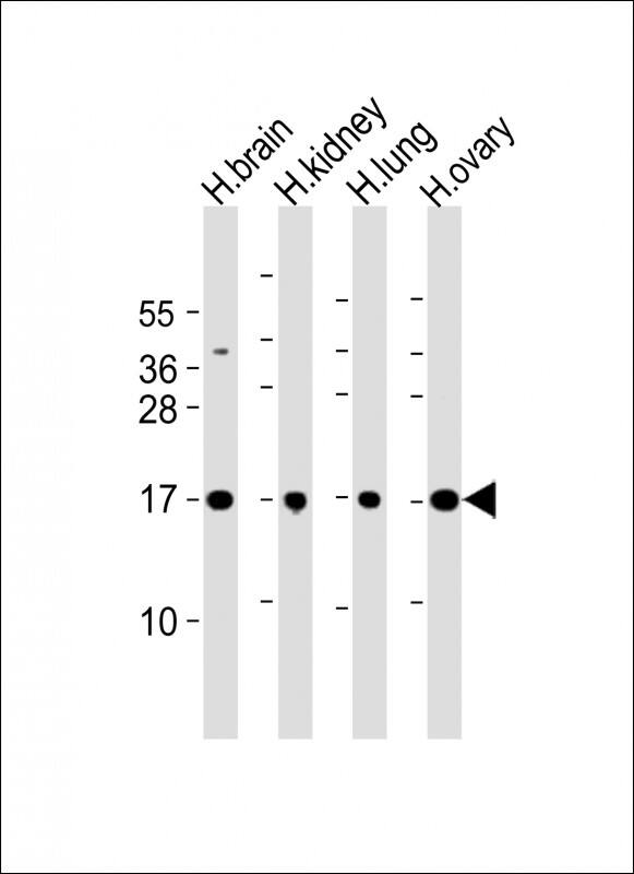 PPIAL4A Antibody (Center) western blot analysis in NCI-H460 cell line lysates (35ug/lane).This demonstrates the PPIAL4A antibody detected the PPIAL4A protein (arrow).