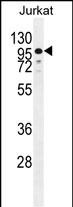 ZNF841 Antibody (N-term) western blot analysis in Jurkat cell line lysates (35ug/lane).This demonstrates the ZNF841 antibody detected the ZNF841 protein (arrow).