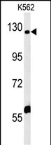 IQSEC3 Antibody (N-term) western blot analysis in K562 cell line lysates (35ug/lane).This demonstrates the IQSEC3 antibody detected the IQSEC3 protein (arrow).