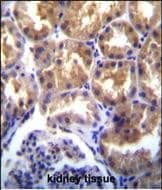Immunohistochemistry-Paraffin TRPM6 Antibody (RB3407)