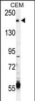 Western Blot TRPM6 Antibody (RB3407)