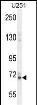 VITRN Antibody (C-term) western blot analysis in U251 cell line lysates (35ug/lane).This demonstrates the VITRN antibody detected the VITRN protein (arrow).