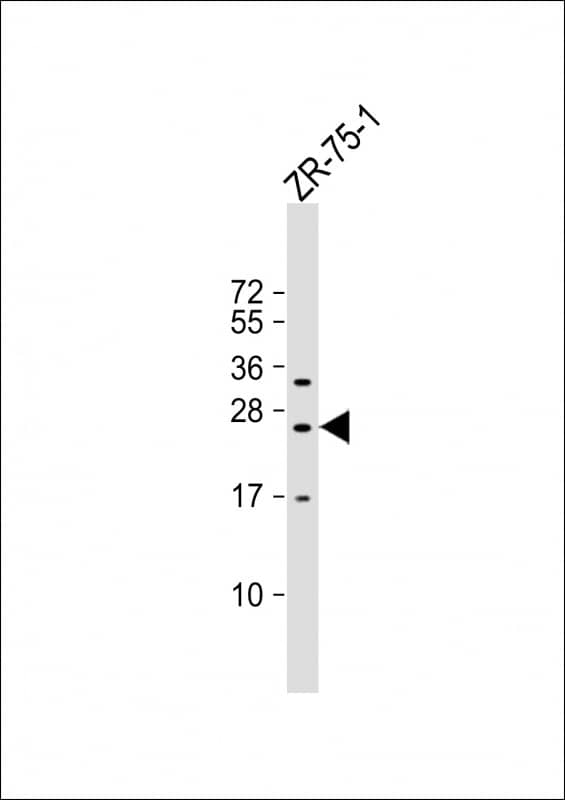 Western Blot NKp65/KLRF2 Antibody (RB38872)