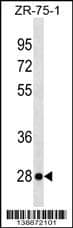 Western Blot NKp65/KLRF2 Antibody (RB38872)