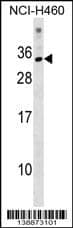 KRBOX1 Antibody (C-term) western blot analysis in NCI-H460 cell line lysates (35ug/lane).This demonstrates the KRBOX1 antibody detected the KRBOX1 protein (arrow).
