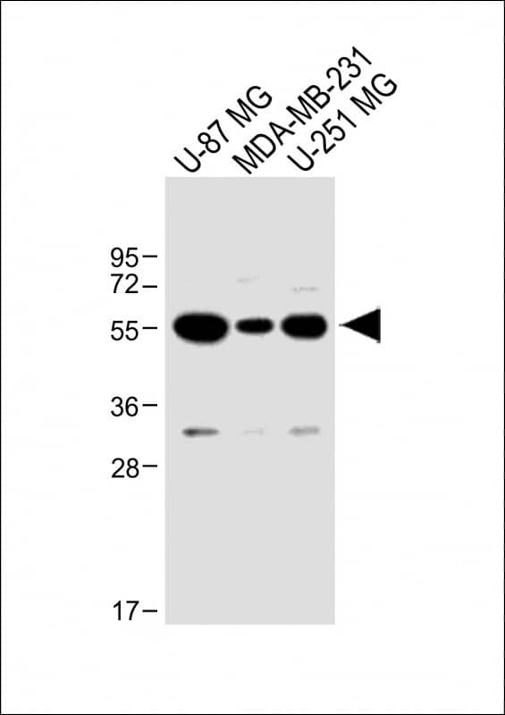 Immunofluorescent analysis of 4% paraformaldehyde-fixed, 0. 1% Triton X-100 permeabilized U-251 MG cells labeling USP17L24 with at 1/25 dilution, followed by Dylight� 488-conjugated goat anti-Rabbit IgG secondary antibody at 1/200 dilution (green). Immunofluorescence image showing Nucleus staining on U-251 MG cell line. Cytoplasmic actin is detected with Dylight� 554 Phalloidin(red). The nuclear counter stain is DAPI (blue).