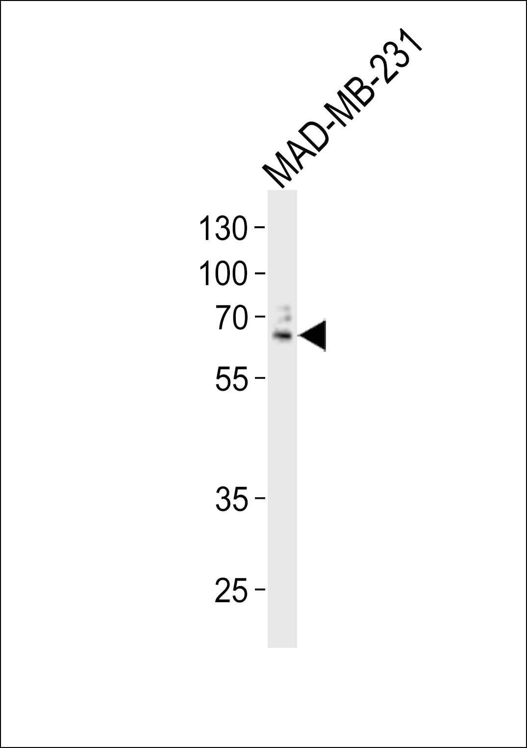 Immunofluorescent analysis of 4% paraformaldehyde-fixed, 0. 1% Triton X-100 permeabilized U-251 MG cells labeling USP17L24 with at 1/25 dilution, followed by Dylight� 488-conjugated goat anti-Rabbit IgG secondary antibody at 1/200 dilution (green). Immunofluorescence image showing Nucleus staining on U-251 MG cell line. Cytoplasmic actin is detected with Dylight� 554 Phalloidin(red). The nuclear counter stain is DAPI (blue).