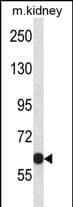 Western Blot Kv3.2 Antibody (RB33946)