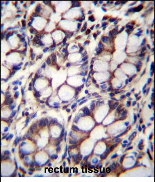 Immunohistochemistry-Paraffin IQCA1 Antibody (RB31637)