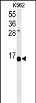 Western Blot HIST1H2AK Antibody (RB26883)