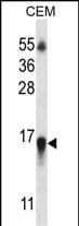 Western Blot HIST1H2BN Antibody (RB32147)