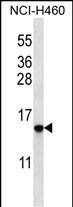 Western Blot HIST1H2BO Antibody (RB32148)