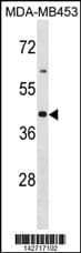 OR2B6 Antibody (C-term) western blot analysis in MDA-MB453 cell line lysates (35ug/lane).This demonstrates the OR2B6 antibody detected the OR2B6 protein (arrow).