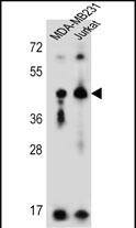 KIR2DL2 Antibody (C-Term) western blot analysis in MDA-MB231,Jurkat cell line lysates (35ug/lane).This demonstrates the KIR2DL2 antibody detected the KIR2DL2 protein (arrow).