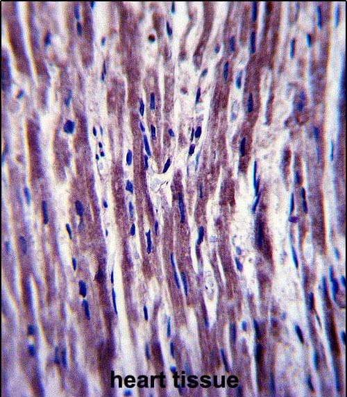 Immunohistochemistry-Paraffin PTPLA Antibody (RB33378)