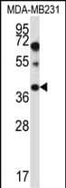 Western Blot PTPLA Antibody (RB33378)