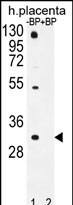 Western Blot OR1D5 Antibody (RB31649)