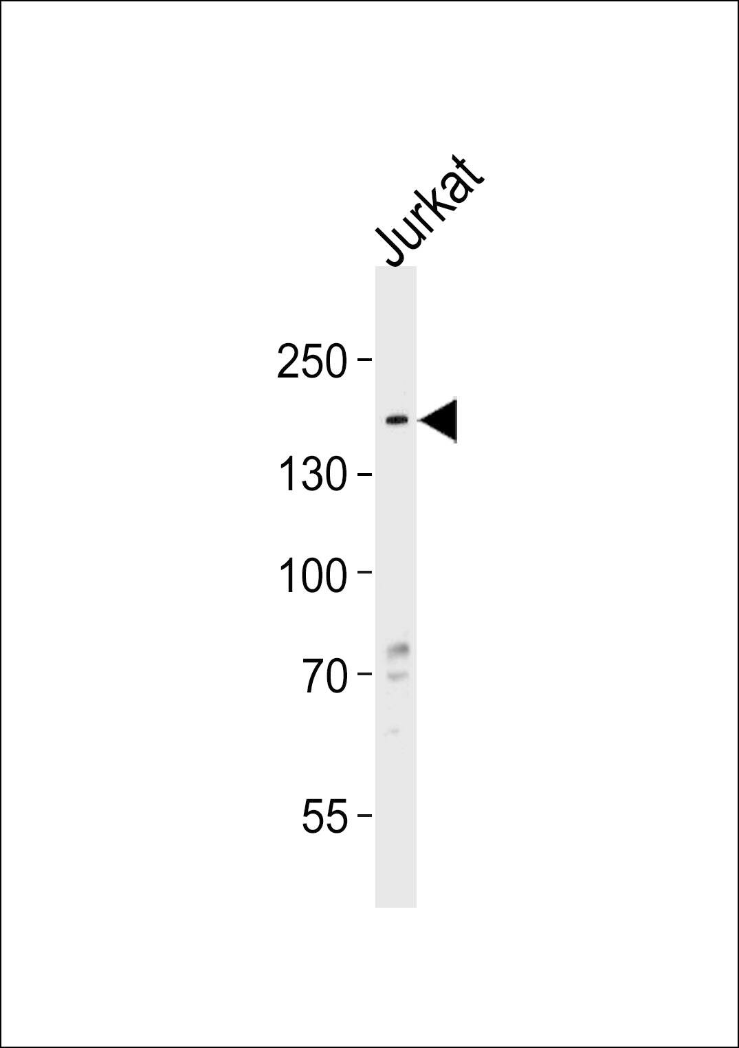 Western blot analysis of lysate from Jurkat cell line, using HMGXB3 Antibody (Center). was diluted at 1:1000 at each lane. A goat anti-rabbit IgG H&L(HRP) at 1:5000 dilution was used as the secondary antibody. Lysate at 35ug per lane.