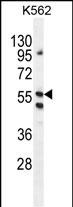 LRIT1 Antibody (C-term) western blot analysis in K562 cell line lysates (35ug/lane).This demonstrates the LRIT1 antibody detected the LRIT1 protein (arrow).
