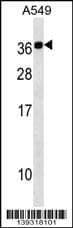 Western Blot Calcium binding protein 2 Antibody (RB39318)