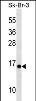 C22orf26 Antibody (C-term) western blot analysis in SK-BR-3 cell line lysates (35ug/lane).This demonstrates the C22orf26 antibody detected the C22orf26 protein (arrow).