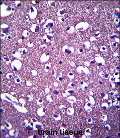 Immunohistochemistry-Paraffin PCDHGA3 Antibody (RB33029)